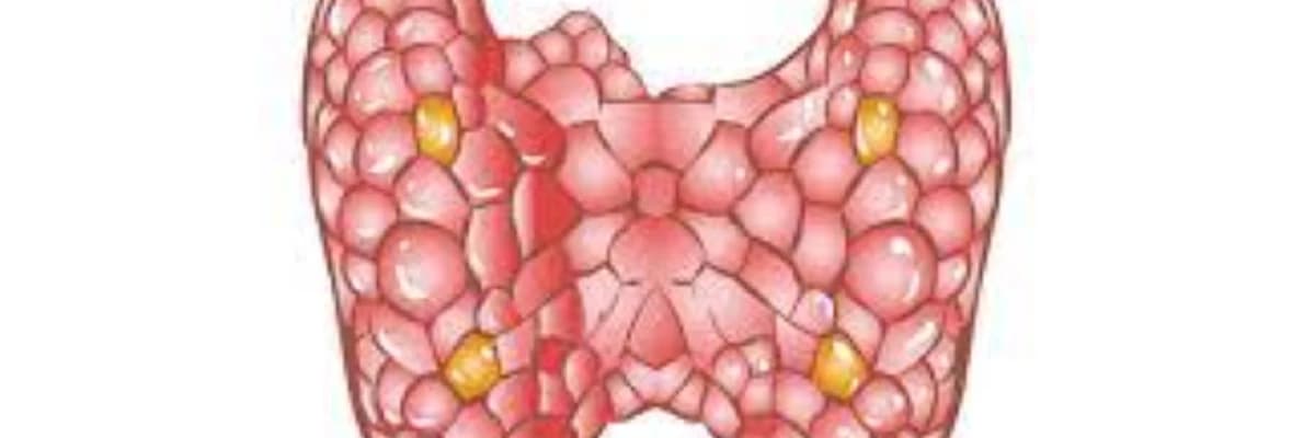 Paratiroid xəstəlikləri