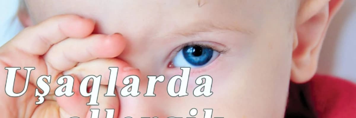 Usaqlarda allergik konyunktivi