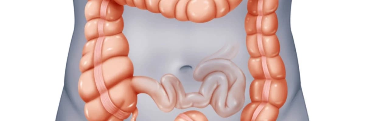 Dolixokolon haqqında