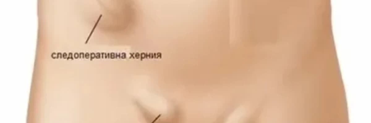 Divaralığı şişləri