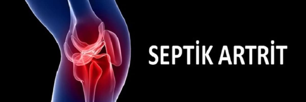 Septik artritlərin konservativ və cərrahi müalicəsi