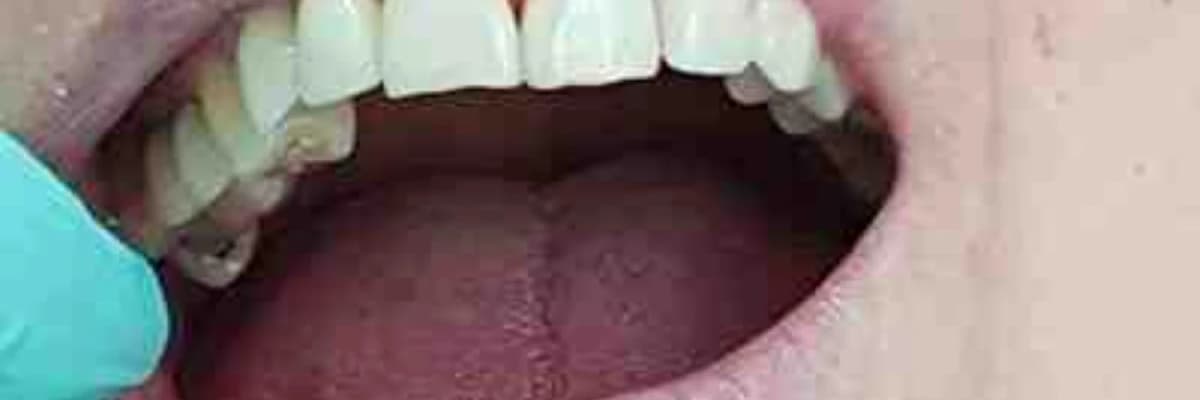 Dişlərin bərk toxumalarının hər növ terapiyası