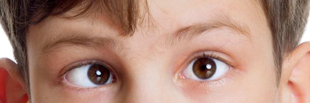 Çəpgözlük (Çəpgözlük): Göz koordinasiyasında pozğunluq