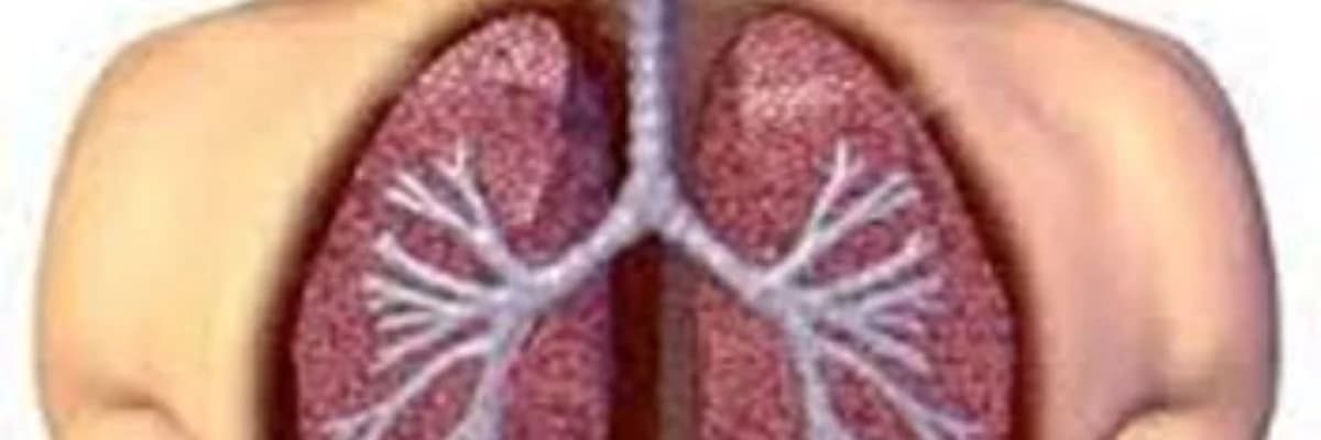 Ağciyərlərin iltihabı, müxtəlif mənşəli plevrit