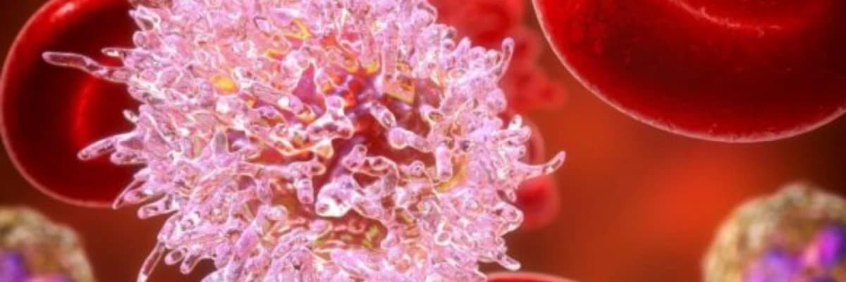 Qan xərçəngi, simptomları və müalicəsi nədir-bilməli olduğunuz şey