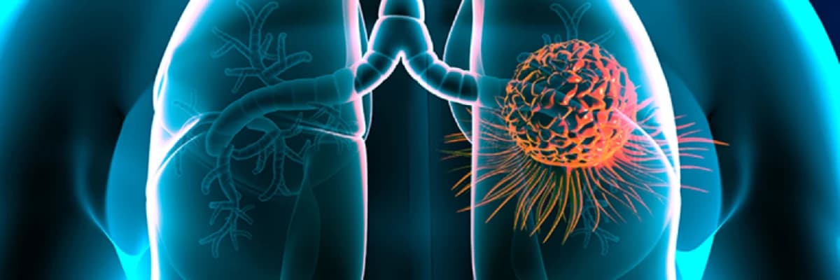 Ağciyərin travmaya bağlı cərrahiyəsi