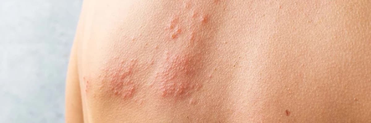 ÜRİKARİYA (AĞRI)