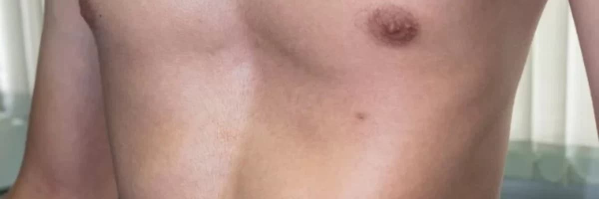 Pektus əməliyyatları