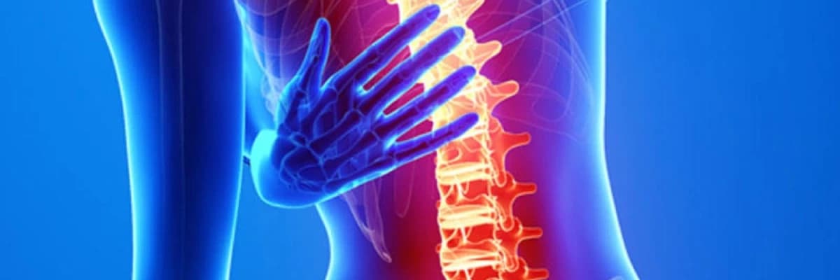 Onurğa sütununun sınıqları