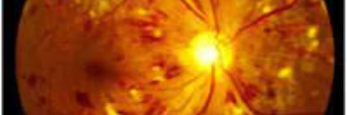 Torlu qişanın vaskulyar ve digər xəstəlikləri