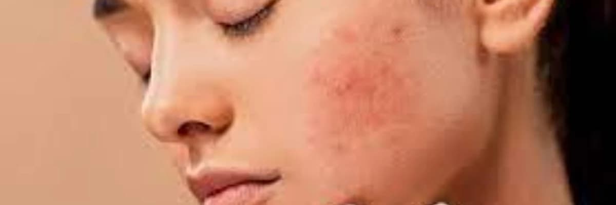 Kalluslar və siğillər