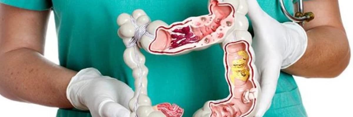 Nazik bağırsağın qaz sistləri