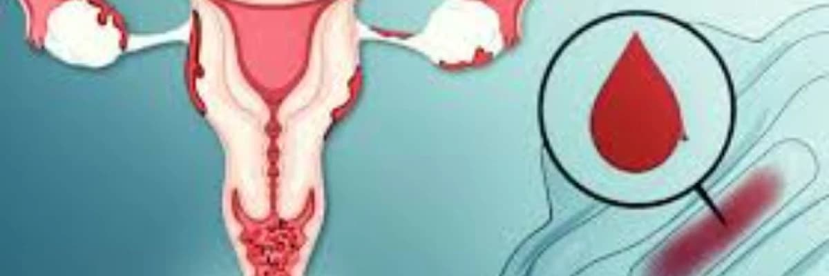 Qanaxma pozğunluqları