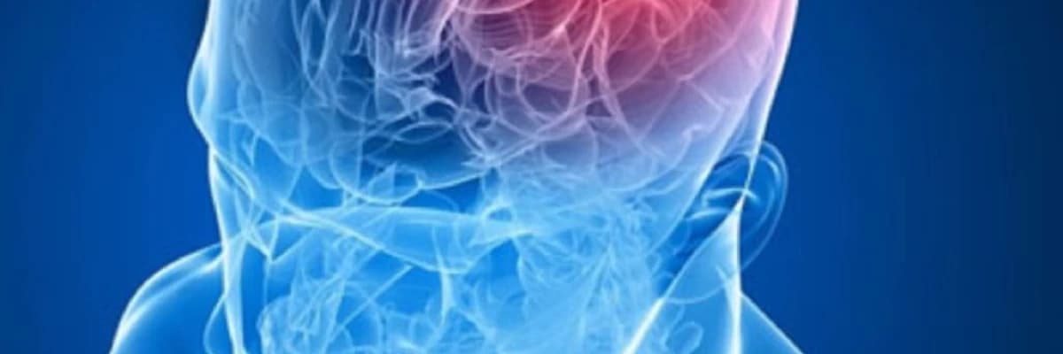 Beyin Şişləri: Tərif, Səbəbləri və Müalicə Yolları