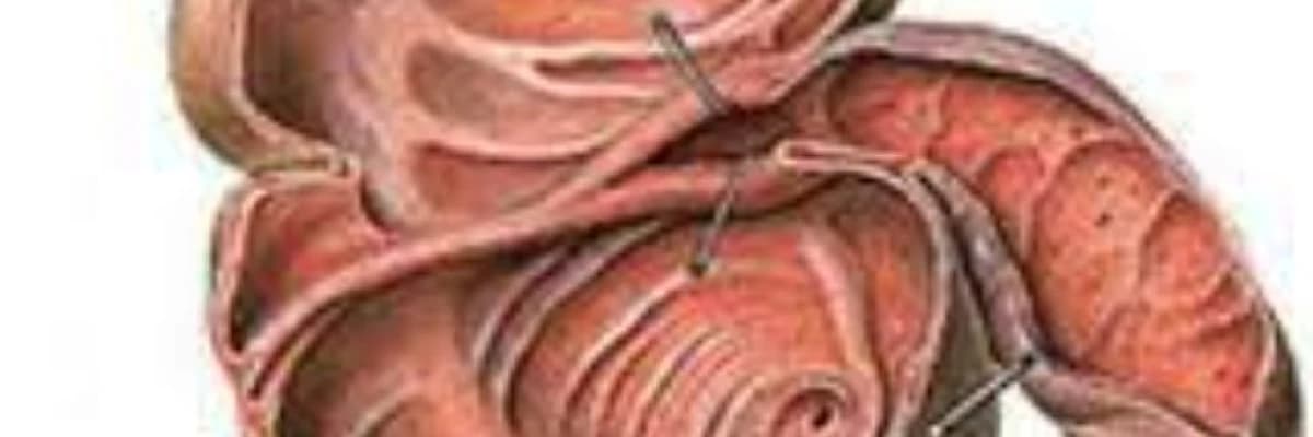 Bauhin qapaginin catismazligi