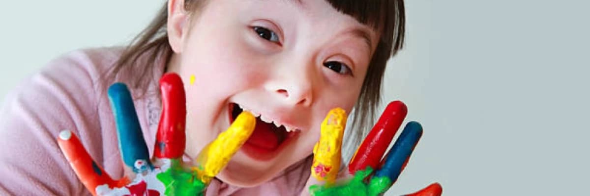 Daun sindromlu uşaqların psixoloji xüsusiyyətləri