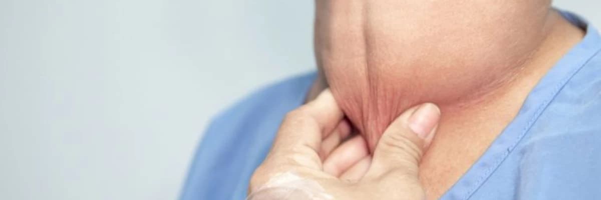 Hipotiroid haqqında müalice