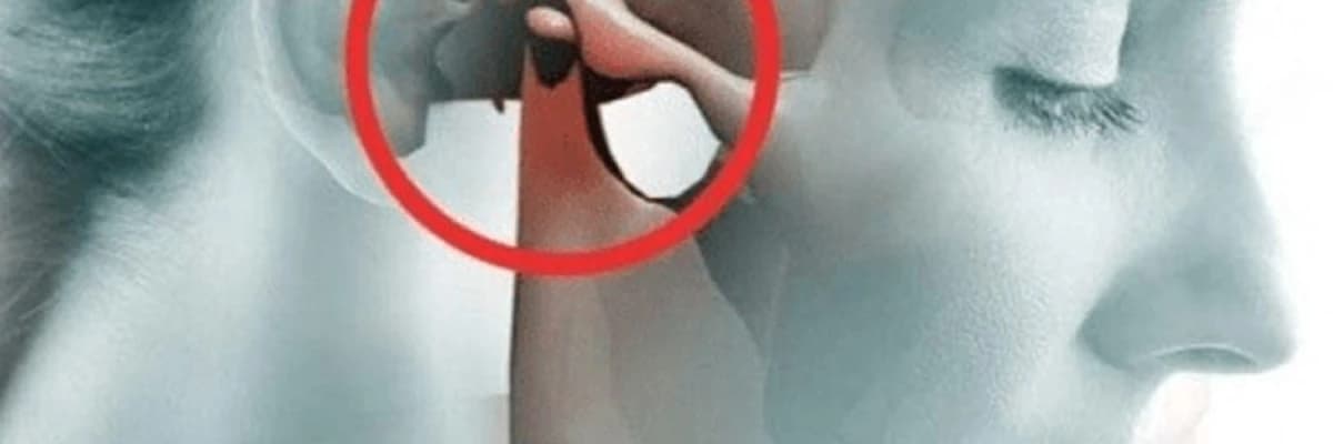 Aşağı çənənin çıxıqları