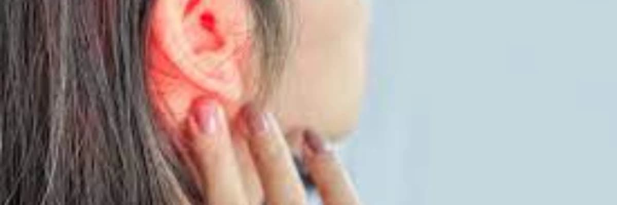 Xarici otit xesteliyi