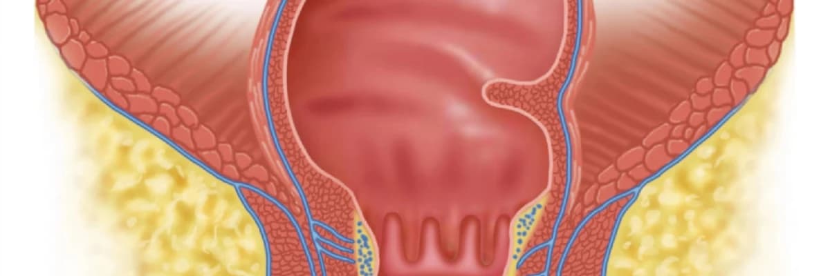 Anal sacaqlar haqqında