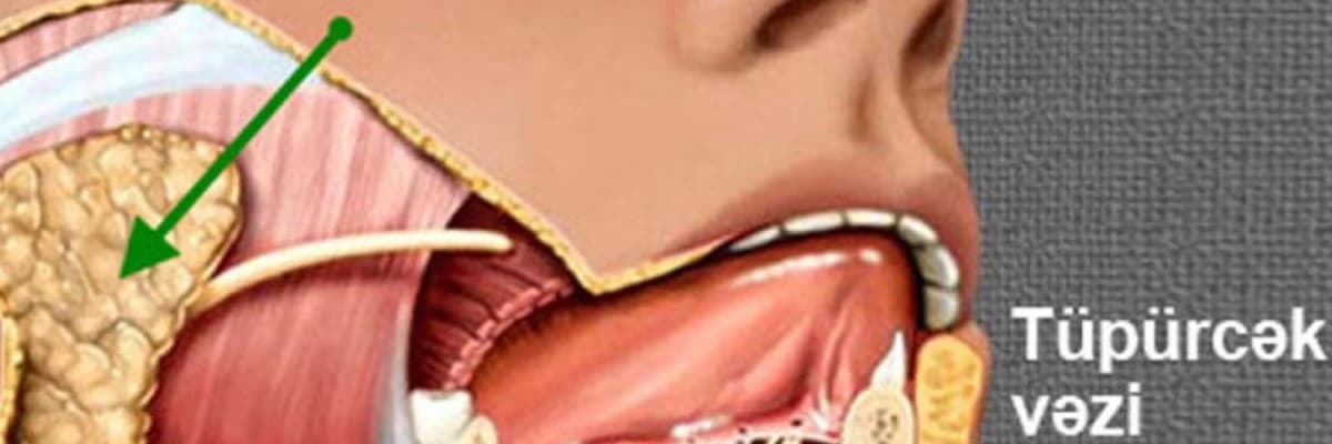 Tüpürcək vəzi problemləri