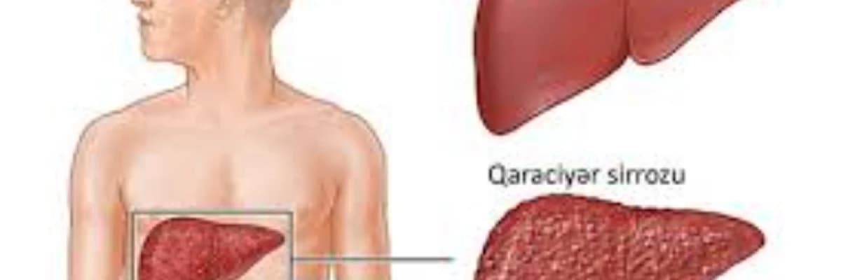 Qaraciyər və böyrək xəstəliklərində qidalanma