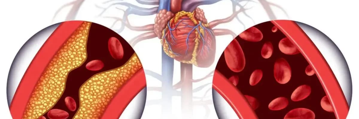 Yüksək Qan Xolesterol və Triqliserit: Sağlamlığımız üçün Niyə Əhəmiyyətlidir?