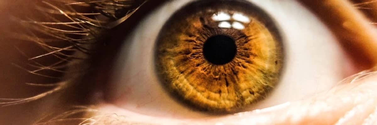 Makula degenerasiyası