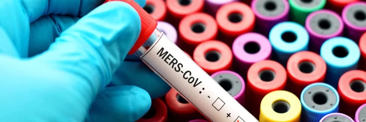 MERS nədir? Semptomlar, müalicə və profilaktika haqqında ən son məlumatlar