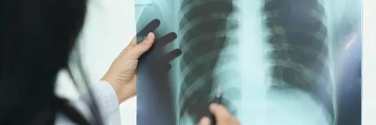 Ağciyər iltihabı: səbəbləri, simptomları və müalicəsi