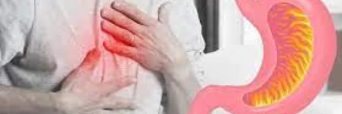 Mədə yanması nədir?