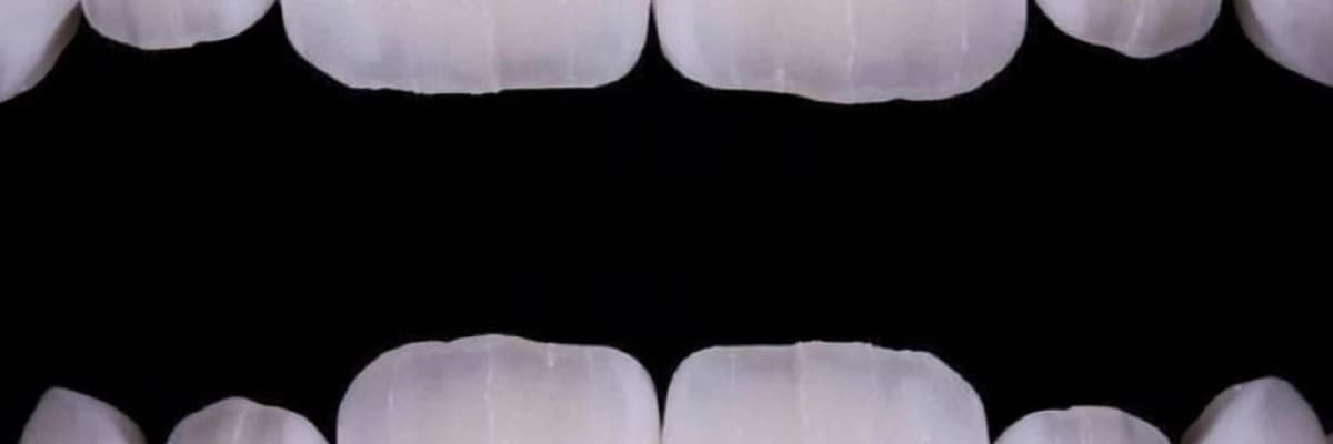 Tam seramik qapaqlar