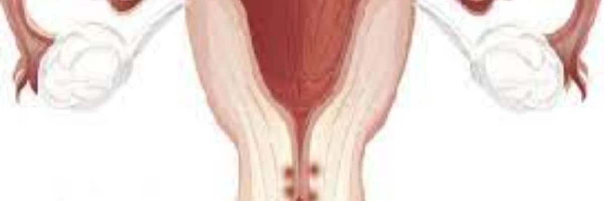 Uşaqlıq boynun endometriozu