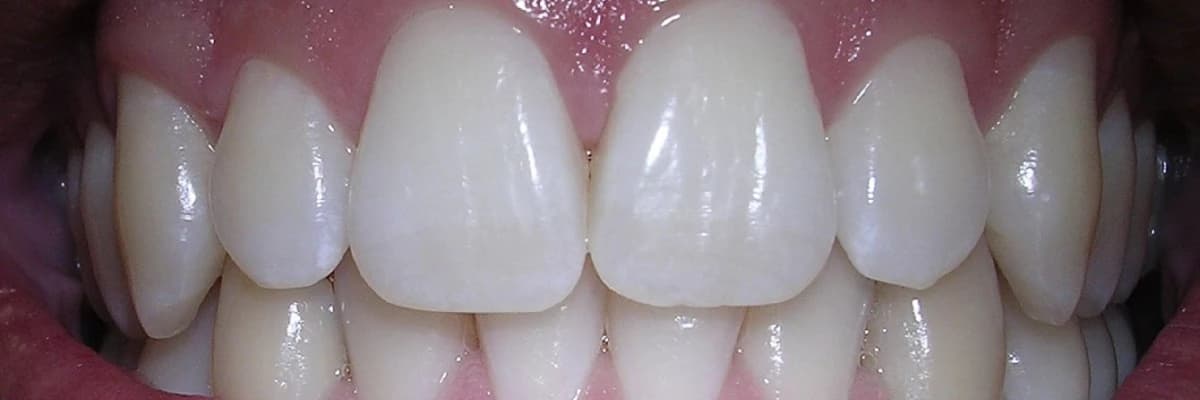 Estetik restavrasiya