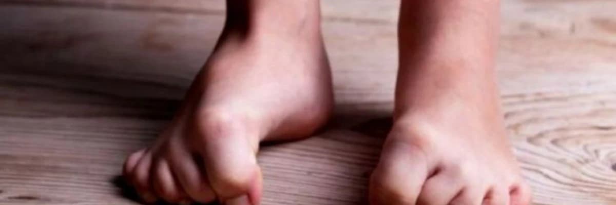 Narahat ayaqlar sindromu