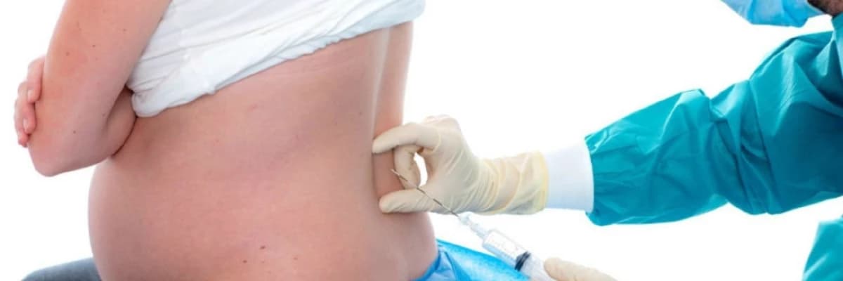 Epidural anesteziya ilə ağrısız normal doğuş