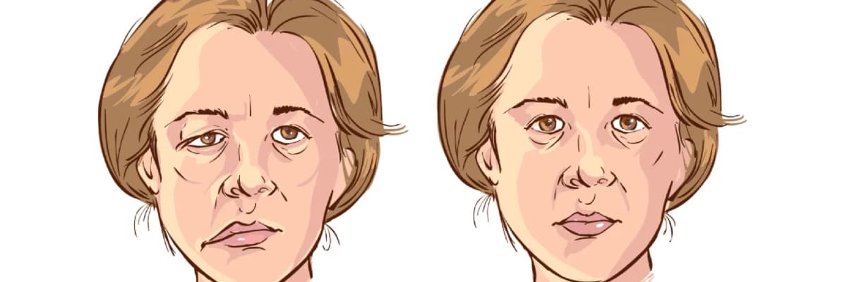 Üz bölgəsində ağrı və uyuşma: səbəbləri və müalicəsi