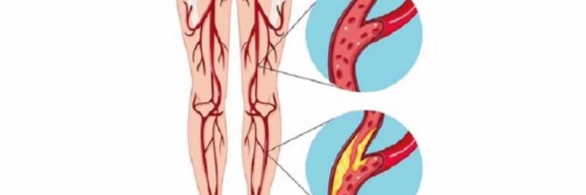 Damar müdaxilələri