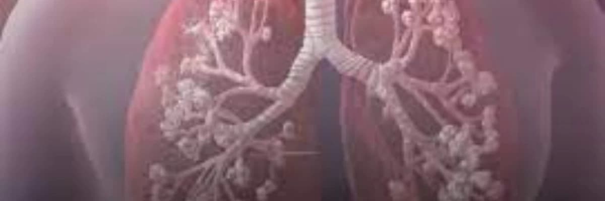 Ağciyər infeksiyalarının cərrahiyəsi (bronxoektaziya xəstəliyi, göbələk xəstəliyi, vərəm xəstəliyi)