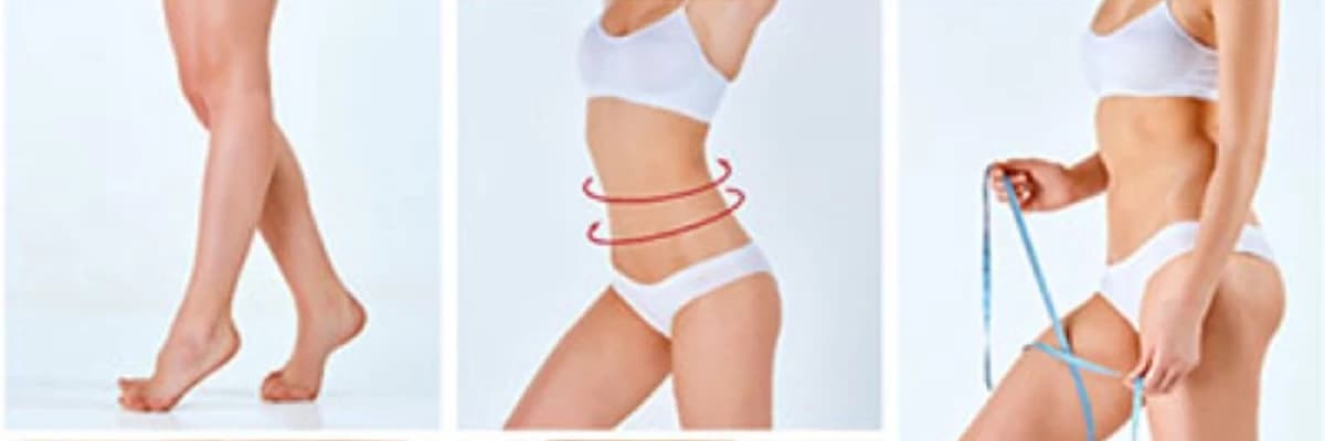 Lipoedema Cərrahiyyəsi: Ağrısız və Estetik Qadın Sağlamlığı