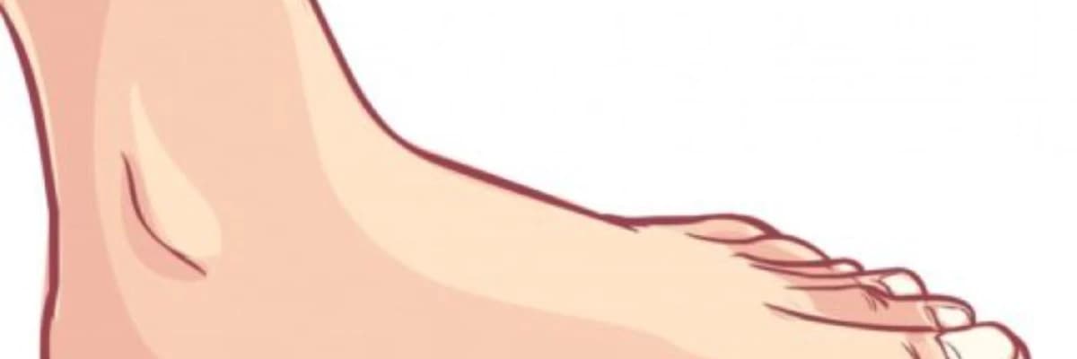 Əl və ayaq çatışmazlıqları və deformasiyaları