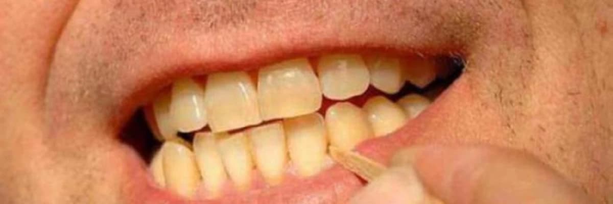 Diş və əti törəmələri:
