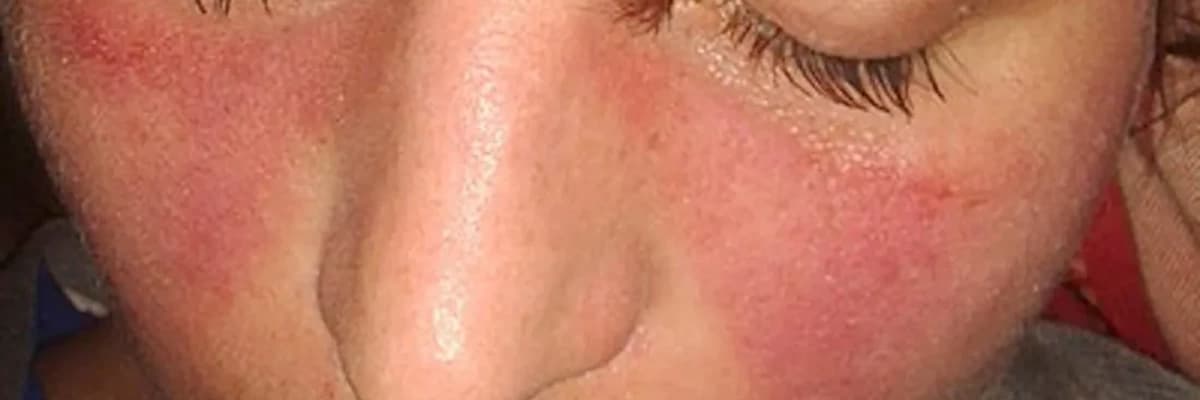 Sistem Qırmızı Qurd Eşənəyi