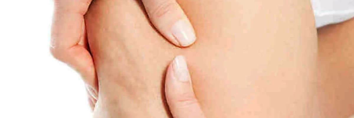 Lipodistrofiya