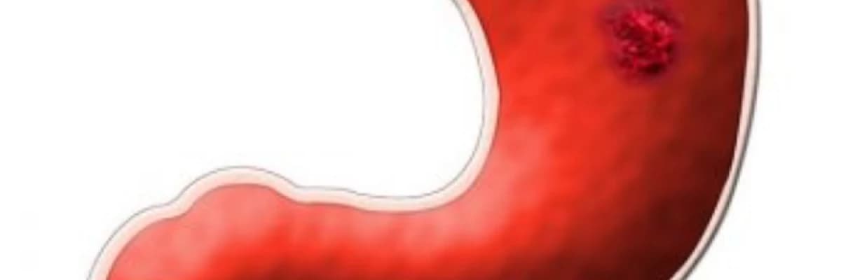 Qida borusunun xorası haqqında