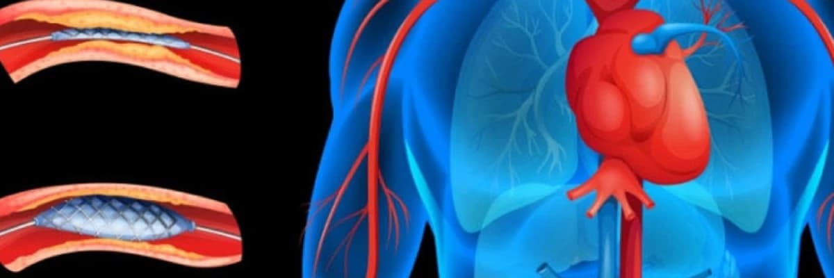 Valvular Ürək Xəstəliyi