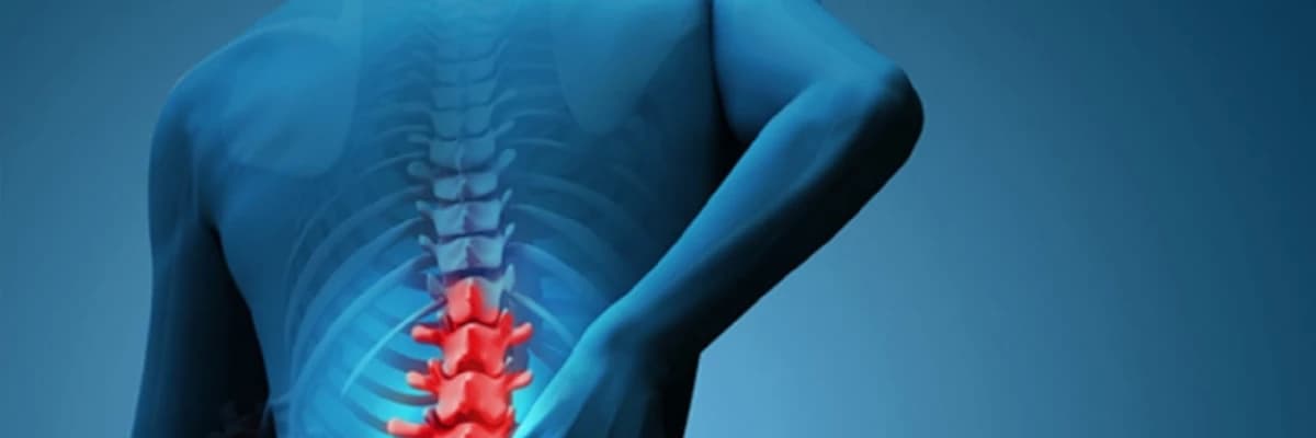 Disk yırtığı əməliyyatının sonrakı keçməyən ağrılar (epidural fibrolizis) və s
