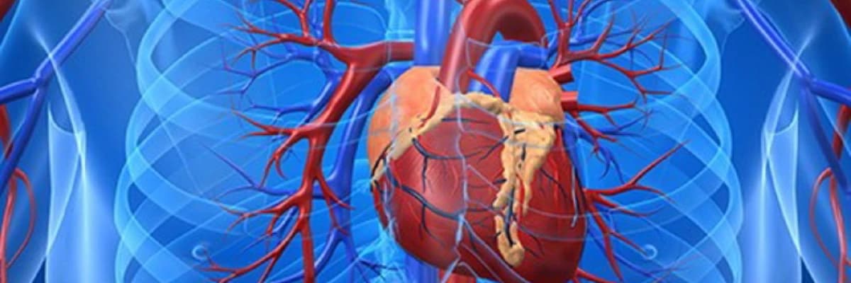 Yüksək qan təzyiqi və xroniki ürək çatışmazlığı da daxil olmaqla ürək-damar xəstəlikləri