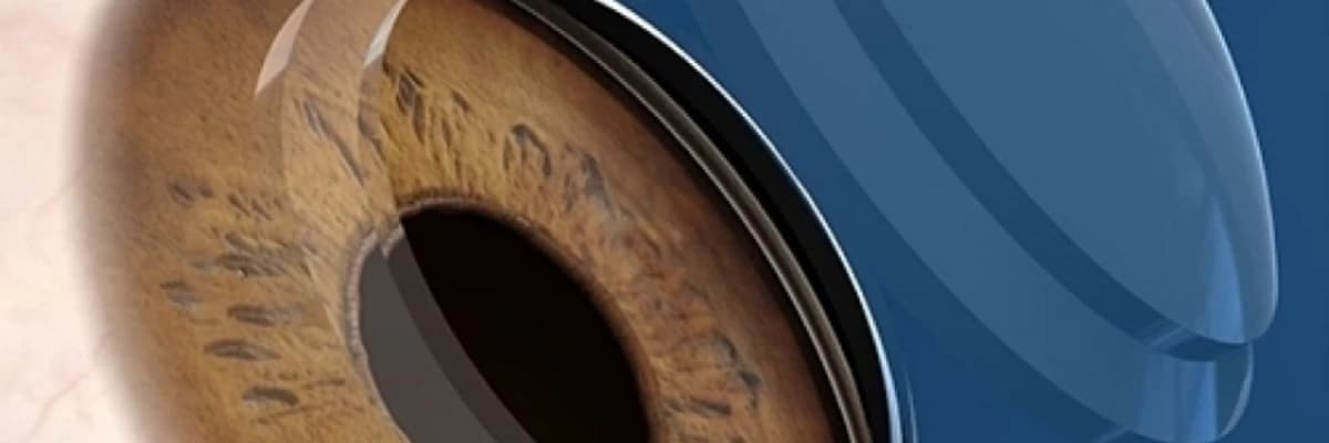 BUYNUZ QİŞA XƏSTƏLİKLƏRİ