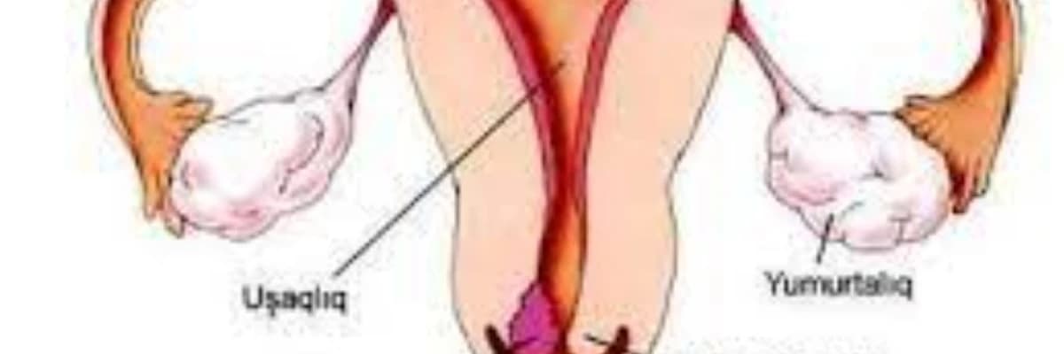 Uşaqlıq boynu, uşaqlıq yolu və vulva toxumalarında şişönü dəyişikliklərə şübhələr